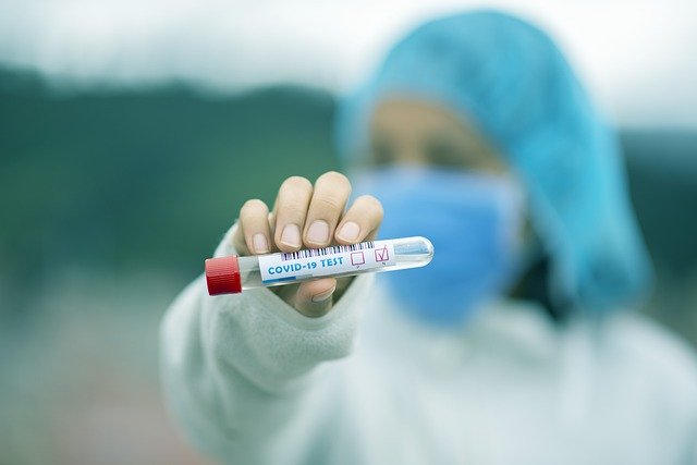 test tube 5065425 640